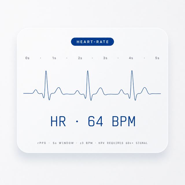 Heart-rate honest · Forum Light